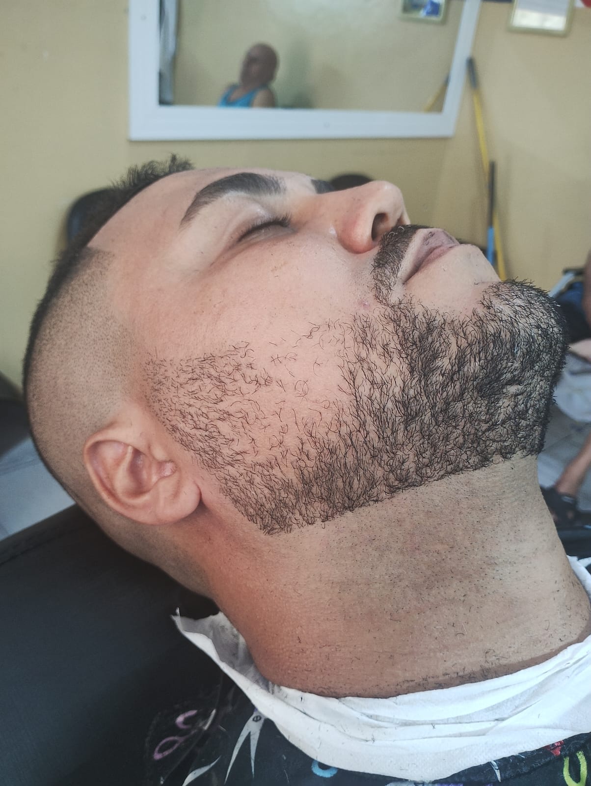 Antes